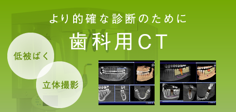 より的確な診断のために 歯科用CT 「低被ばく」「立体撮影」